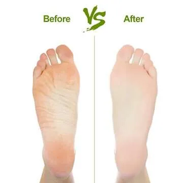 Natural Pumice Stone Set for Foot and Hand Care