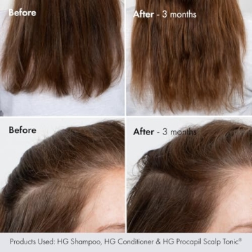 BondiBoost HG Duo Shampoo + Conditioner Bundle [10.14fl oz each] - Improves Appearance for Thinning Hair - Volumizing + Hydrating + Nourishing - Sulfate/Paraben Free, for Women/Men - Australian Made