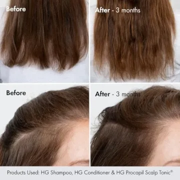 BondiBoost HG Duo Shampoo + Conditioner Bundle [10.14fl oz each] - Improves Appearance for Thinning Hair - Volumizing + Hydrating + Nourishing - Sulfate/Paraben Free, for Women/Men - Australian Made