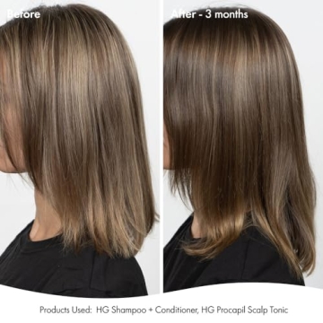 BondiBoost HG Duo Shampoo + Conditioner Bundle [10.14fl oz each] - Improves Appearance for Thinning Hair - Volumizing + Hydrating + Nourishing - Sulfate/Paraben Free, for Women/Men - Australian Made