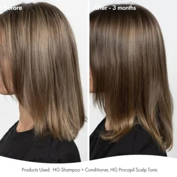 BondiBoost HG Duo Shampoo + Conditioner Bundle [10.14fl oz each] - Improves Appearance for Thinning Hair - Volumizing + Hydrating + Nourishing - Sulfate/Paraben Free, for Women/Men - Australian Made