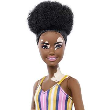 Barbie Fashionistas Doll #135 with Natural Curly Hair & Vitiligo Wearing Striped Dress & Accessories Including Sneakers & Fanny Pack