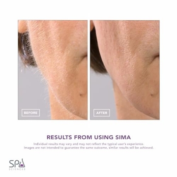 SPA SCIENCES SIMA Dermaplaning Tool – Painless Facial Exfoliation