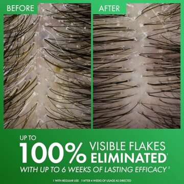 Dercos Selenium Sulfide Anti Dandruff Shampoo, Eliminates Flakes & Fights Recurring Dandruff & Itchy Scalp, Color Safe Shampoo, 2X Less Breakage, Suitable For All Hair Types, 6.76 Fl. Oz.