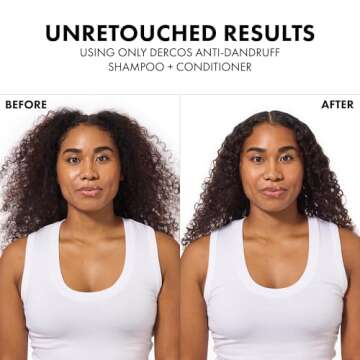 Dercos Selenium Sulfide Anti Dandruff Shampoo, Eliminates Flakes & Fights Recurring Dandruff & Itchy Scalp, Color Safe Shampoo, 2X Less Breakage, Suitable For All Hair Types, 6.76 Fl. Oz.