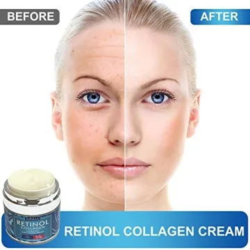 Revitalize Your Skin with Retinol Cream for Face