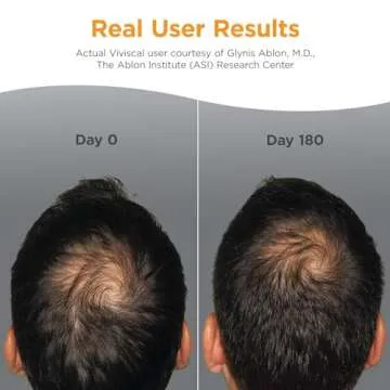 Viviscal Men's Hair Growth Supplements for Fuller Hair