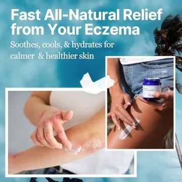 Ocean Healed Eczema Cream with Sea Moss for Sensitive Skin