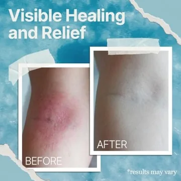 Ocean Healed Eczema Cream with Sea Moss for Sensitive Skin