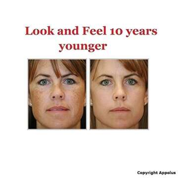 Microdermabrasion Machine - Appolus Premium Diamond Microdermabrasion Anti-Aging SkinTightening Device - 2 Diamond Tips - 5 Heads - Blackhead Blemishes Remover - Pore Line Wrinkle Sagging Minimizer