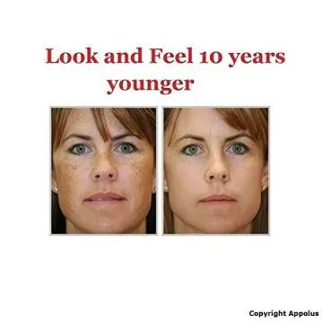 Microdermabrasion Machine - Appolus Premium Diamond Microdermabrasion Anti-Aging SkinTightening Device - 2 Diamond Tips - 5 Heads - Blackhead Blemishes Remover - Pore Line Wrinkle Sagging Minimizer