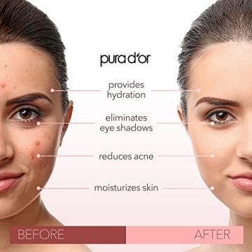 PURA D'OR Organic Sweet Almond Oil for Skin & Hair Care