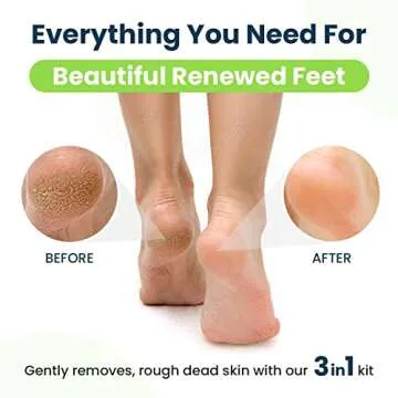 Professional Callus Remover Gel & Pumice Stone Set for Feet