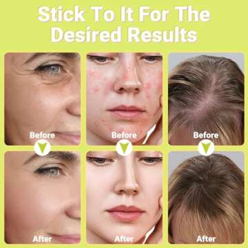 High Frequency Facial Wand - Uaike Orange Portable Handheld High Frequency Facial Machine - with 4 Pcs Orange Glass Tubes - at Home Skin Face Wand Device