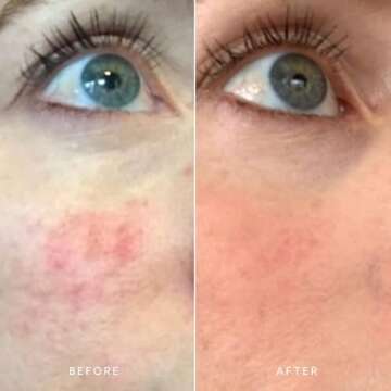 True Botanicals - Organic CALM Pure Radiance Face Oil | Clean, Non-Toxic, Natural Skincare (1 fl oz | 30 ml)