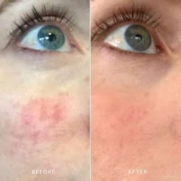 True Botanicals - Organic CALM Pure Radiance Face Oil | Clean, Non-Toxic, Natural Skincare (1 fl oz | 30 ml)