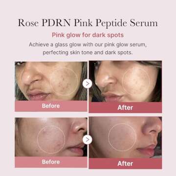 medicube Rose PDRN Pink Trio Set : Medicube PDRN Pink Peptide Serum & Toner & Jelly Gel Mask (1 Count (Pack of 4))