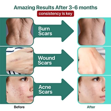 Tattoo Aftercare Bundle: Healing Balm & Scar Gel