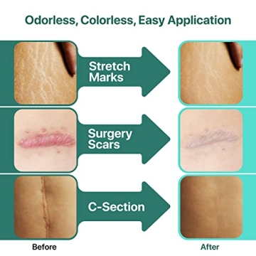 Tattoo Aftercare Bundle: Healing Balm & Scar Gel