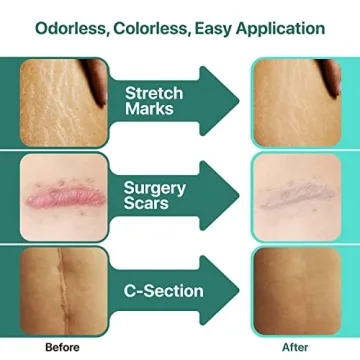 Tattoo Aftercare Bundle: Healing Balm & Scar Gel