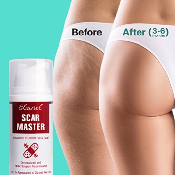 Tattoo Aftercare Bundle: Healing Balm & Scar Gel