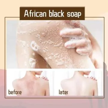 African Deep Cleansing Exfoliating Shea Butter Natural Black Soap Bar Magic Anti Rebelles Beauty Moisturizing Deep Natural Bath Body Treatment Acne Skin Care