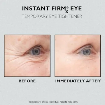 Peter Thomas Roth Instant FIRMx Eye Tightener for Youthful Eyes