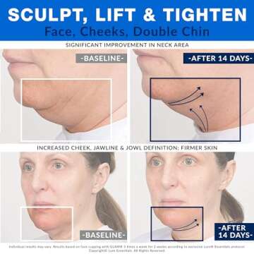 Glass Facial Cupping Set (4 Cups) Cupping Therapy for Face Eyes Lips