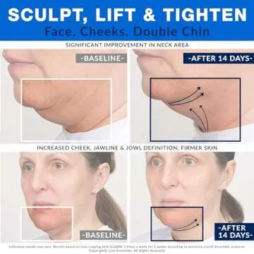 Glass Facial Cupping Set (4 Cups) Cupping Therapy for Face Eyes Lips