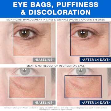 Glass Facial Cupping Set (4 Cups) Cupping Therapy for Face Eyes Lips