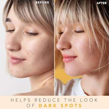 Vitamin C Face Toner - USA Made with Natural & Organic Ingredients, Alcohol-Free Skin Brightening Fa...