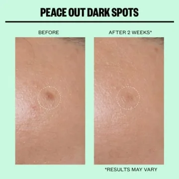 Peace Out Skincare Dark Spots Microstructure Dots