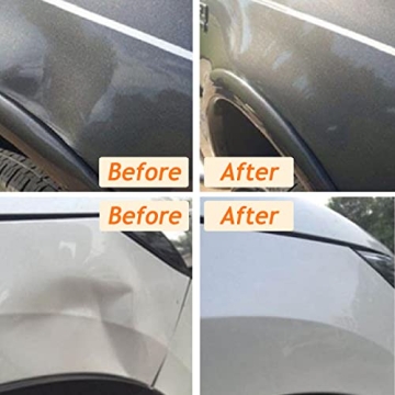 Tricess Dent Puller - Perfect for Cars and Tiles