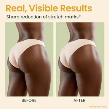 Bio Pure Skincare Oil for Stretch Marks and Scars