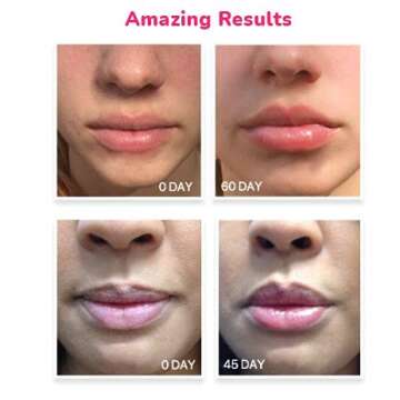 LifeCell Lip Plumping Treatment for Fuller Lips