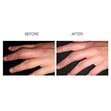 Scarfade Silicone Scar Gel for Effective Scar Therapy