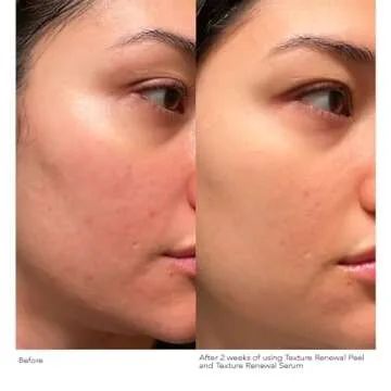 Dr. Dennis Gross Advanced Retinol + Ferulic Texture Renewal Serum: for a Smooth, Retextured Complexion 1 oz