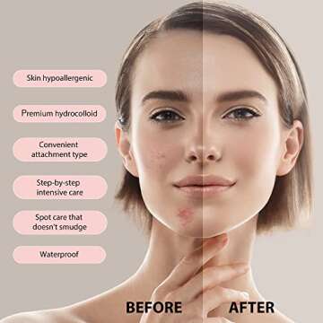 Haruto Acne Pimple Patches Original (92 patches/1pack) in 2 Sizes - Acne Patches, Hydrocolloid, Blemish Spot Treatment Dots Breakout Care