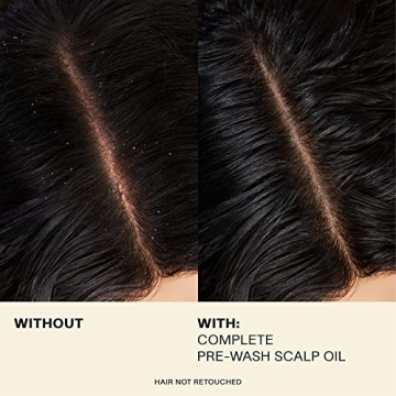 JVN Hair and Scalp Treatment Oil for All Hair Types