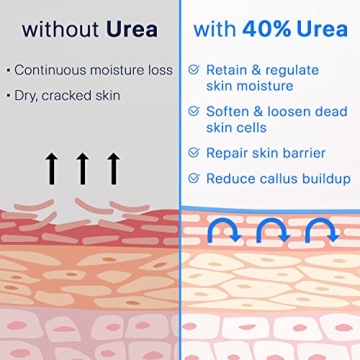 Ebanel Urea Cream 40% for Soft and Healthy Feet