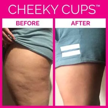 Cheeky Cups Anti-Cellulite Massage Cup Set for Body Contouring