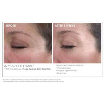 Glowbiotics Advanced Retinol Renewal Treatment: Nightly Anti-Aging Cream for Smoother, Brighter Skin | Firms & Reduces Pores with Retinol