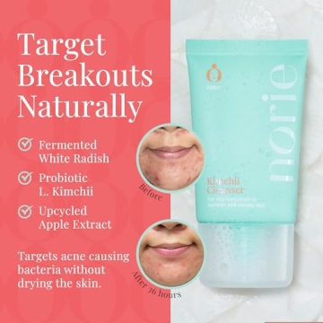 Gentle Face Cleanser for Oily Skin with Probiotics