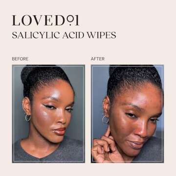 Loved01 Face & Body Salicylic Acid Cleansing Wipes, John Legend Skincare, Oil & Fragrance-Free, No-Rinse, Suitable for Blemish-Prone Skin, 24 wipes