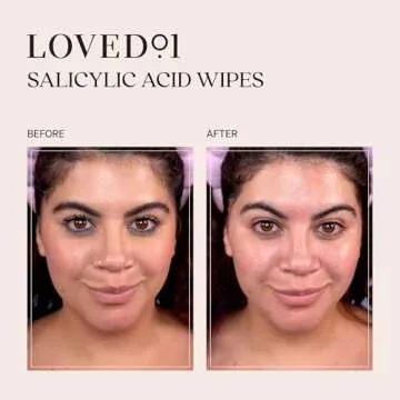 Loved01 Face & Body Salicylic Acid Cleansing Wipes, John Legend Skincare, Oil & Fragrance-Free, No-Rinse, Suitable for Blemish-Prone Skin, 24 wipes