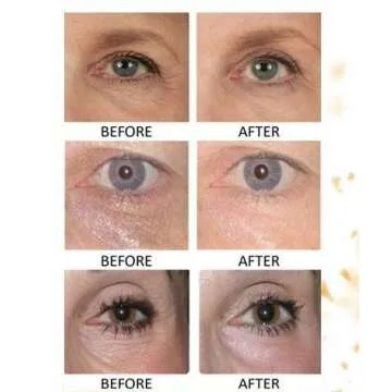 30 Pairs of 24K Gold Collagen Eye Masks for Youthful Skin