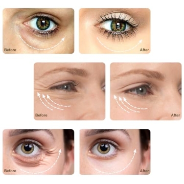 Microcurrent Eye Lift Massager for Youthful Skin