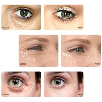 Microcurrent Eye Lift Massager for Youthful Skin