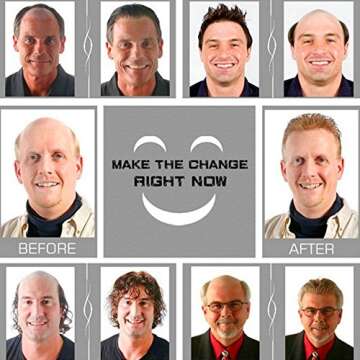 Hollywood Toupee for men Hair pieces for men N.L.W. European virgin human hair replacement system for men 10x8"human hair prosthesis units patch implant for men #1 Jet Black