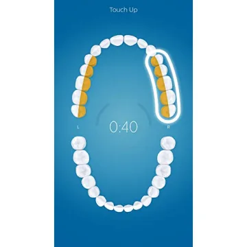 Philips Sonicare DiamondClean Smart 9500 Rechargeable Electric Power Toothbrush, White, HX9924/01